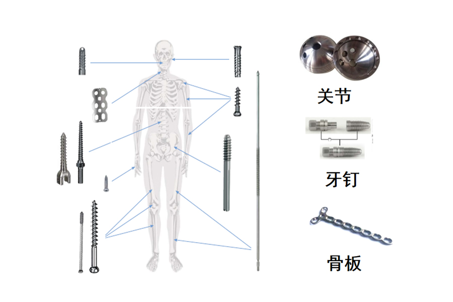 醫(yī)療骨科、牙釘、脊椎